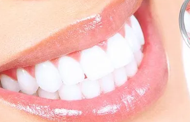 分光测色仪如何应用在牙齿美白领域