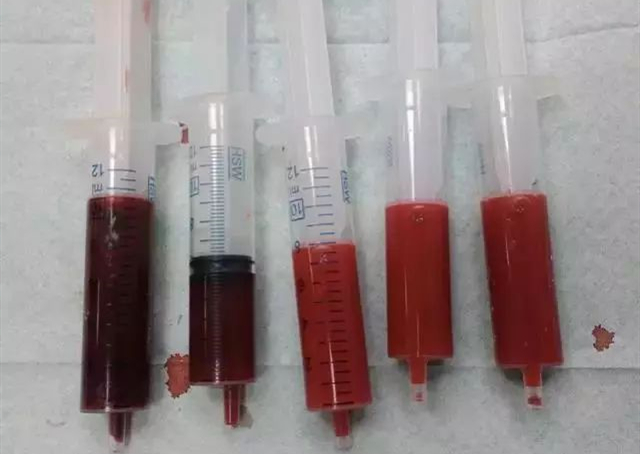 血液的颜色差异如何辨别？